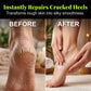 Tea Tree Oil Foot Cream for Dry Cracked Feet